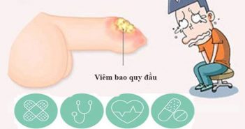 Những nguy hiểm mà bệnh viêm bao quy đầu gây nên viêm bao quy đầu