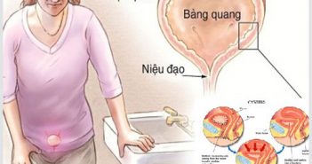 Viêm đường tiết niệu gây ra nguy hiểm gì? viêm đường tiết niệu